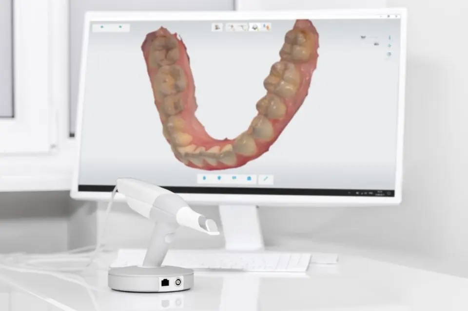 חיוך מושלם מתחיל בעבודה מקצועית